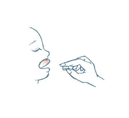 舌下免疫療法